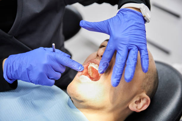 Best Emergency Dentist for Knocked-Out Tooth in Arnold, CA